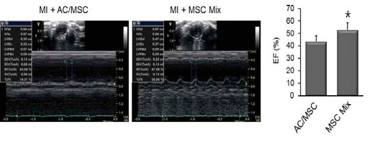 병합 hBMC 이식에 의한 심기능 회복을 심장 초음파 검사로 확인하였음