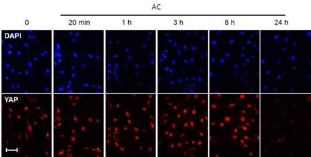 AC처리에 의해 YAP 단백 발현이 시간별로 감소하였음