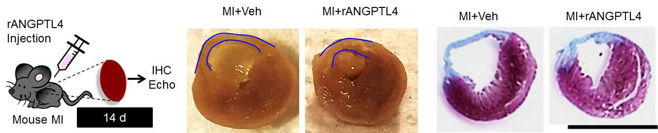 ANGPTL4 처리에 의한 경색심근의 구조 보존 및 심근 섬유화 감소
