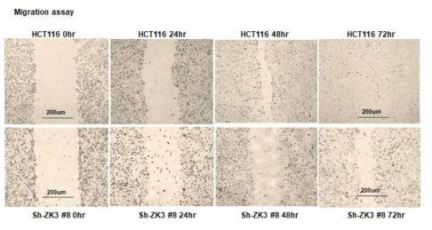 Migration assay in wild type or zkscan3-knockdown HCT 116 cells