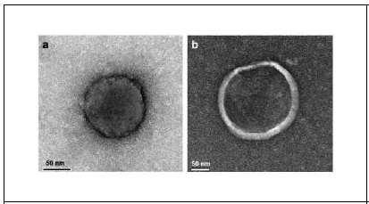 SEM image (좌) Liposome, (우) 키토산 코팅된 Liposome)