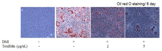 Toxifolin에 의한 3T3-L1 지방세포에서 지방과립의 세포내 축척억제