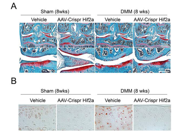 DMM 골관절염 모델에서 AAV-CRISPR Hif2a 시스템의 표현형: (A) safrarin-O 염색과 (B) MMP-13 면역염색