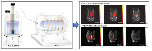 초분극 기술 기반의 미래 도전형 암 조기진단 시스템 및 MRI imaging