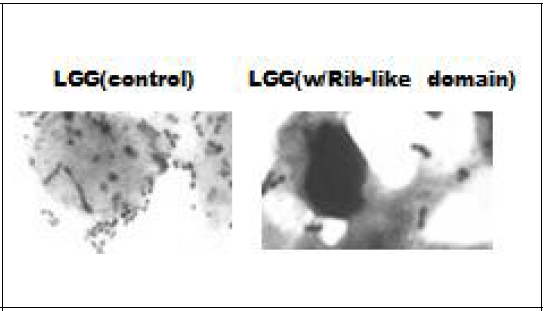 Rib-like domain의 장관상피세포주에 대한 유산균 흡착저해 관찰