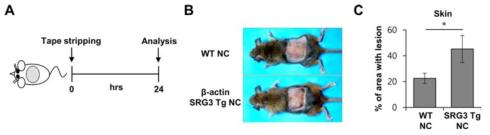 β-actin-SRG3 Tg NC/Nga 생쥐에서 tape stripping에 의한 피부염 유도