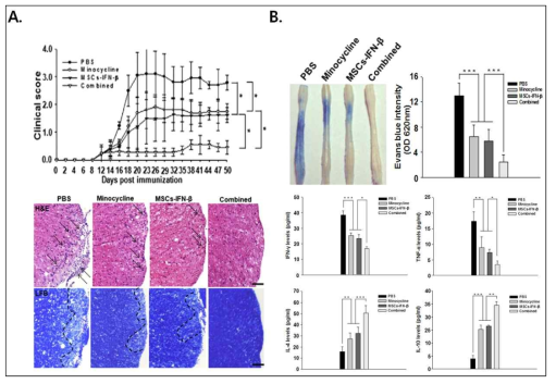 다발성경화증에서 Minocycline과 MSCs-IFNβ의 병용치료