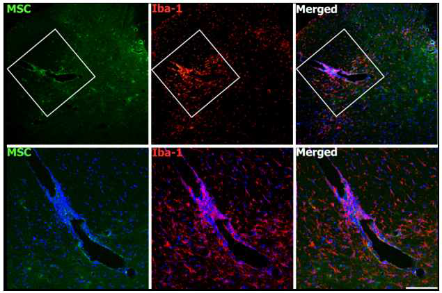 EAE에서 중간엽줄기세포의 이동능력 평가 (in vivo)