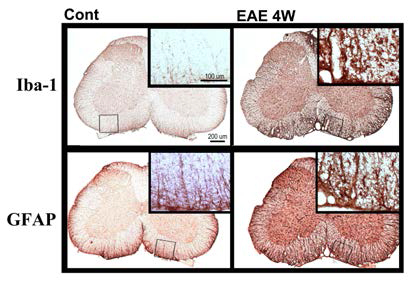 Iba-1 과 GFAP 염색