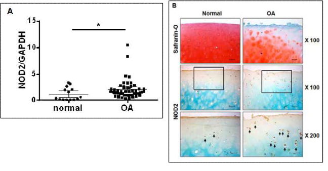 NOD2 expression increased in OA cartilage and 29-kDa FN-f-treated chondrocytes