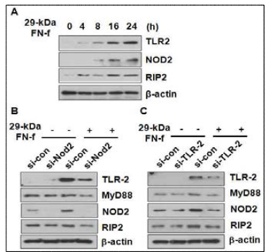 NOD2와 TLR-2는 상호간의 adaptor 분자의 발현 조절