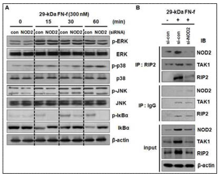 29-kDa FN-f의 NOD2/RIP2/TAK1 신호 체계를 통한 NF-kB 신호 활성화