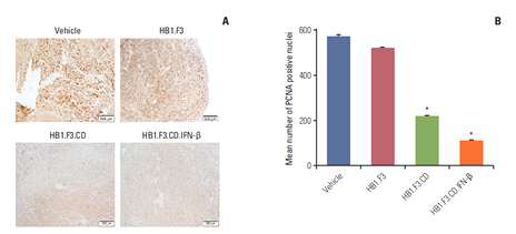 Tumor 조직에 대한 immunochemistry로 확인한 PCNA 발현 변화