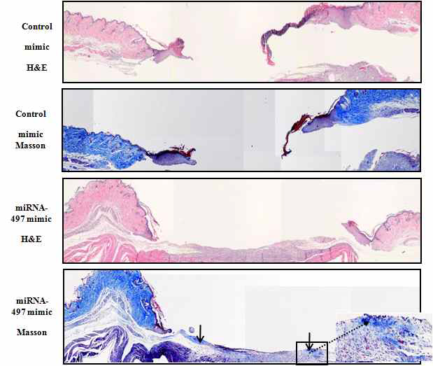 miRNA-497 mimic 혹은 negative control miRNA mimic을 투여한 후 4일 째 취한 당뇨 유발 마우스 모델의 피부 조직의 사진을 통해 miRNA-497 mimic을 투여한 마우스 모델에서 콜라겐 생성과 함께 demise 가 뚜렷이 회복되고 있음을 확인