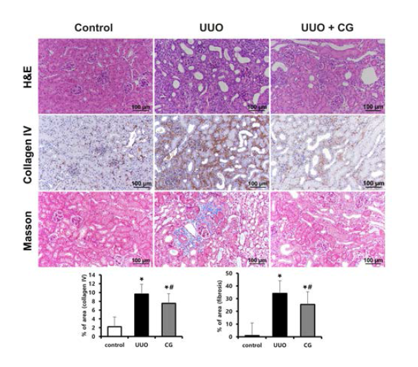 UUO 신장에서 시행한 H&E 염색, Collagen IV 면역조직화학 염색 및 Masson-trichrome 염색