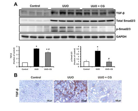 A TGF-β, Smad 의 western blot 결과. B. TGF-β의 면역조직화학염색 결과