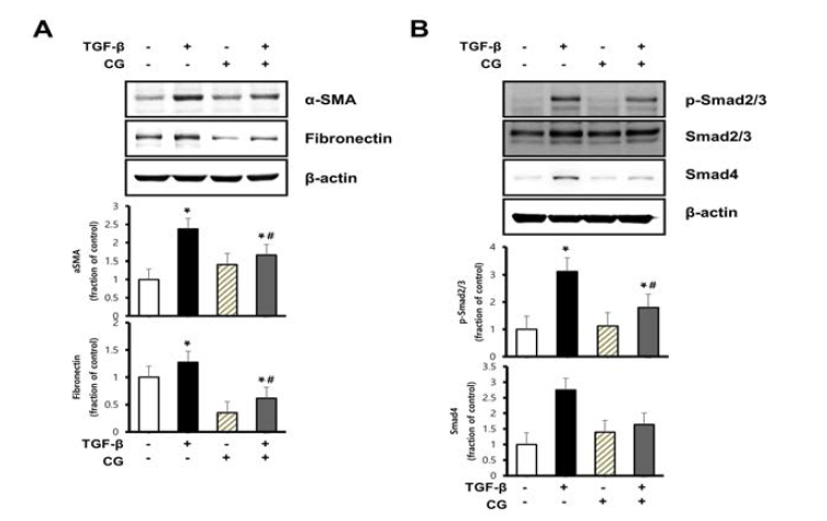 TGF-b를 처리한 HK-2세포에서 신섬유화 마커의 단백발현