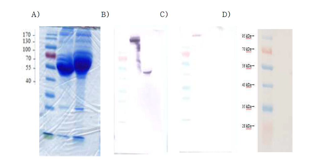 SDS-PAGE (A) and Immunoblot of FA21 monoclonal antibody with anti-Ig gamma (B), kappa (C) and lambda light (D) antibodies. The FA21 samples were treated at room temperature without β-mercaptanethanol (first lanes) or treated at 100℃ with β -mercaptoethanol (second lanes)