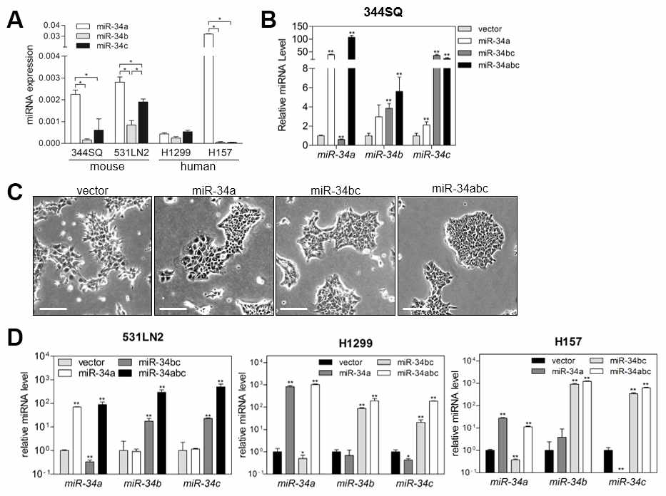 miR-34a와 miR-34b/c 과발현 폐암 세포 구축 A. 생쥐 및 인간 페암세포에서 miR-34a, b, c의 발현양 조사 B. 344SQ세포에서 miR-34a와 miR-34b/c 과발현 C. miR-34를 과발현한 344SQ세포의 모양 변화 D. 다른 폐암세포들에서 miR-34a와 miR-34b/c 과발현