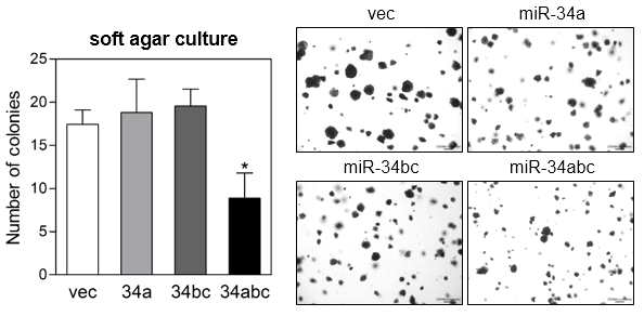 soft agar culture에서 miR-34a와 miR-34b/c 조합의 항암 시너지 효과 조사