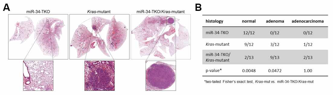 (A) H&E 염색 후 마우스 폐 조직 관찰. (B) 정상, adenoma, adenocarcinoma의 비율 분석