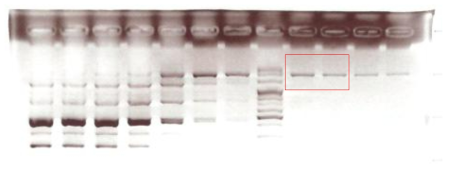 전기영동으로 확인한 PAI-1 3′UTR의 Gradient PCR band