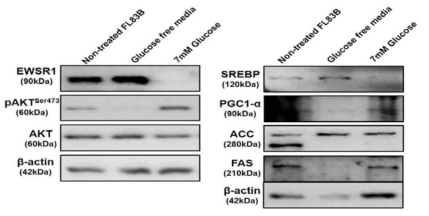 Glucose 처리에 따른 EWSR1과 phospho AKT/AKT level