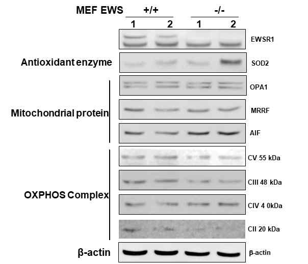 EWSR1 유무에 따른 미토콘드리아 관련 유전자의 발현 차이