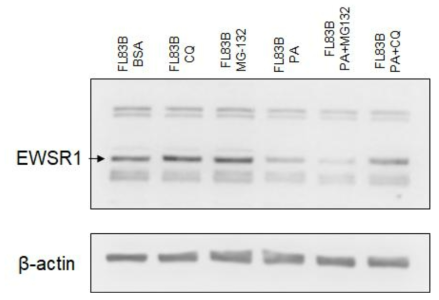 protein degradation inhibitor 처리에 따른 EWSR1의 발현