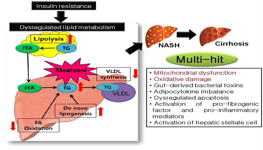 비알콜성 지방간 발병원인