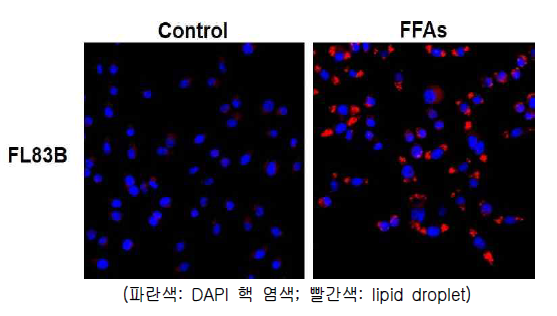 FFA 처리에 따른 EWSR1 발현