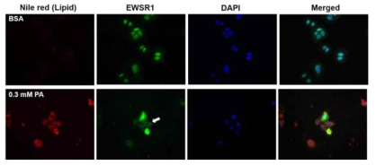 PA 처리에 따른 EWSR1의 발현과 위치