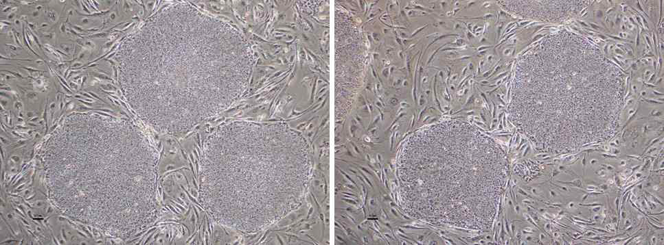 분양된 hiPS 세포의 계대배양을 통한 세 포 안정화 후 세포 이미지