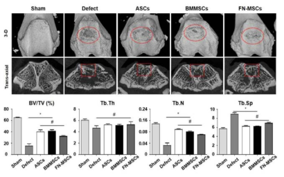 연골하골층 Micro-CT 분석 결과