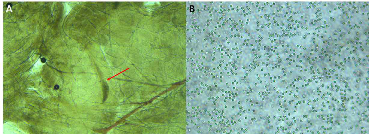 넙치 근육내 (A) K. septempunctata의 pseudocyst (B) 순수 분리한 K. septempunctata spores