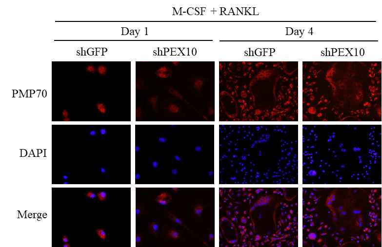 Effects of Pex10 knock-down on peroxisome formation in osteoclasts