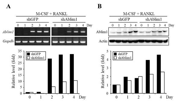 ABLIM1-specific knockdown on RANKL-induced osteoclastogenesis