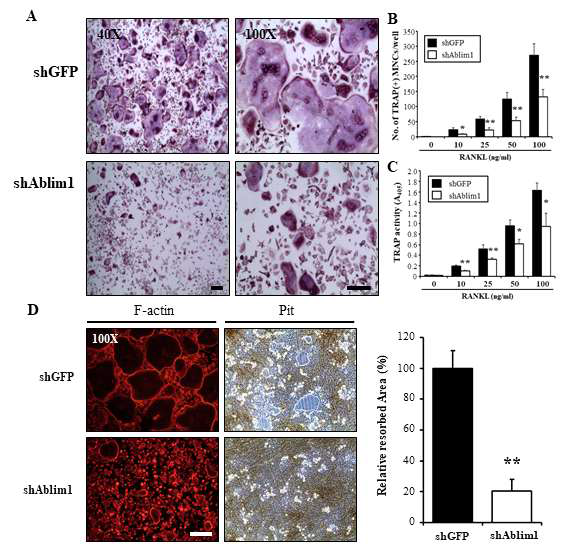 Effects of ABLIM1-specific knockdown on RANKL-induced osteoclast differentiation and activation. *P ＜0.05, **P ＜ 0.01 versus control (shGFP). Scale bar = 200 um