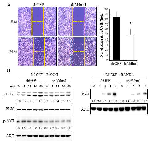 Effects of ABLIM1-specific knockdown on RANKLmediated osteoclast mobility