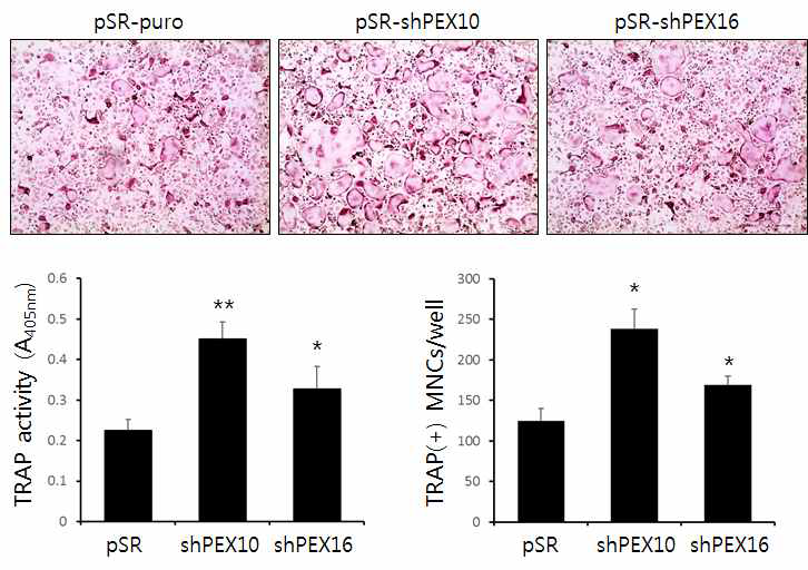Effect of knock-down of Pex10 or Pex16 on RANKLmediated osteoclastogenesis