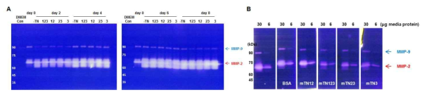 지방세포분화에 따른 ECM protein의 활성 변화 및 tetranectin에 의한 MMP 활성 조절. (A), 3T3-L1의 지방세포분화 과정에 MMP-2와 MMP-9 발현과 활성 분석, (B), tetranectin 단백질의 MMP-2와 MMP-9 활성 억제 효과