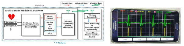 헬스케어 센서 인터페이스 구조 및 스마트폰을 이용한 실시간 심전도 모니터링