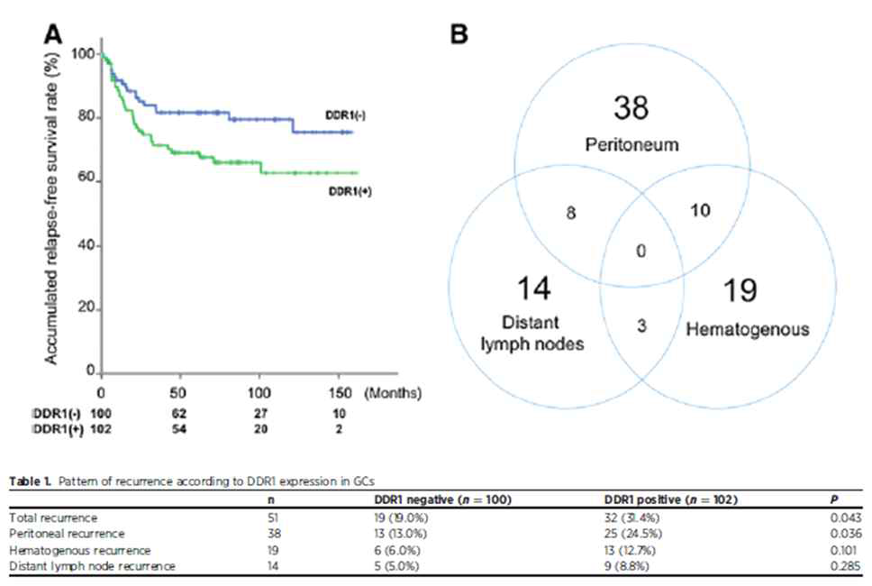 (A) DDR1 발현이 높은 위암 조직에서 낮은 무병 생존률을 확인 (B) 복막 전이가 가장 흔한 재발 장소임을 확인 (Table 1) 복막 전이 재발과 DDR1의 발현 양성이 양의 상관관계가 있음을 확인함