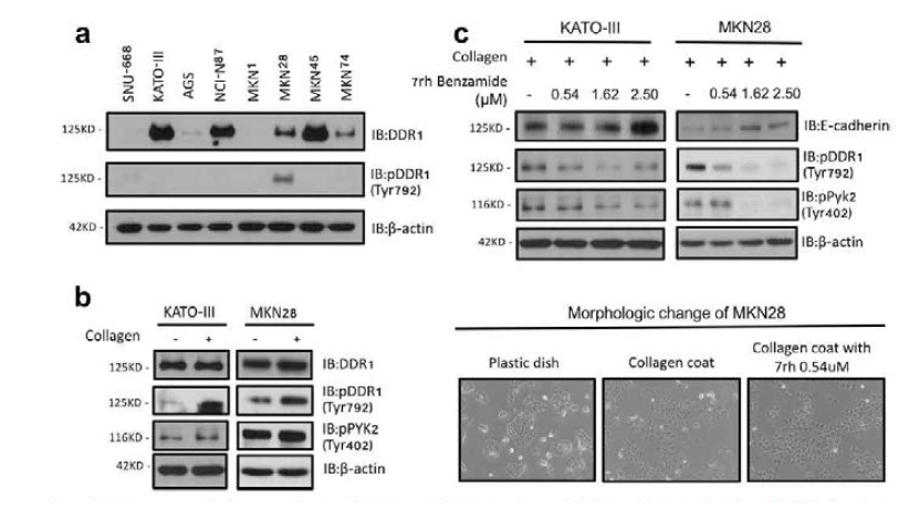 (a) 위암세포주들에서 DDR1의 발현과 활성화를 확인함 (b) 콜라겐 자극에 의해서 DDR1의 활성화를 확인함 (c) 7rh 투여에 의해서 E-cadherin의 발현이 증가함을 확인하였으며, 콜라겐에 의해서 중배엽 모양으로 변했던 위암 세포주가 7rh에 의해서 다시 상피세포로 변함을 확인함
