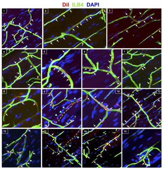 hPSC-EC/nanomatrix gel 이식 후 10개월에 vasculogenic effects 분석