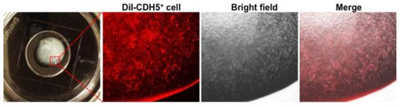 Nanomatrix gel를 이용한 인간만능줄기세포 유래 혈관내피세포캡슐 제작