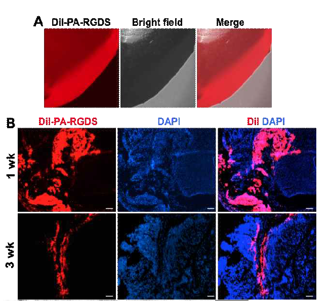 Nanomatrix gel의 생체내 자연분해되는 특징 확인. (A) 소수성 붉은 형광색소, CM-DiI로 염색된 nanomatrix gel (B) 쥐 하지허혈조직에 이식 후 1주, 3주에 조직검사 사진. DAPI=쥐 조직세포, DiI=nanomatrix gel