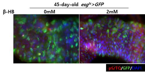 ketone body 관련 약물 후처리시 증가한 DNA damage repair