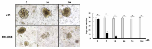 Mouse intestinal organoid의 형성. Src inhibitor인 datinib를 처리한 곳에서 농도 의존적으로 오가노이드의 형성이 줄어드는 것을 확인할 수 있었음