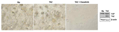 TAZ 과발현 오가노이드, TAZ를 과발현 시킨 오가노이드에 Src inhibitor를 처리한 결과, TAZ 단백질에 의한 오가노이드 형성이 Src inhibitor에 의해 저해됨을 확인함
